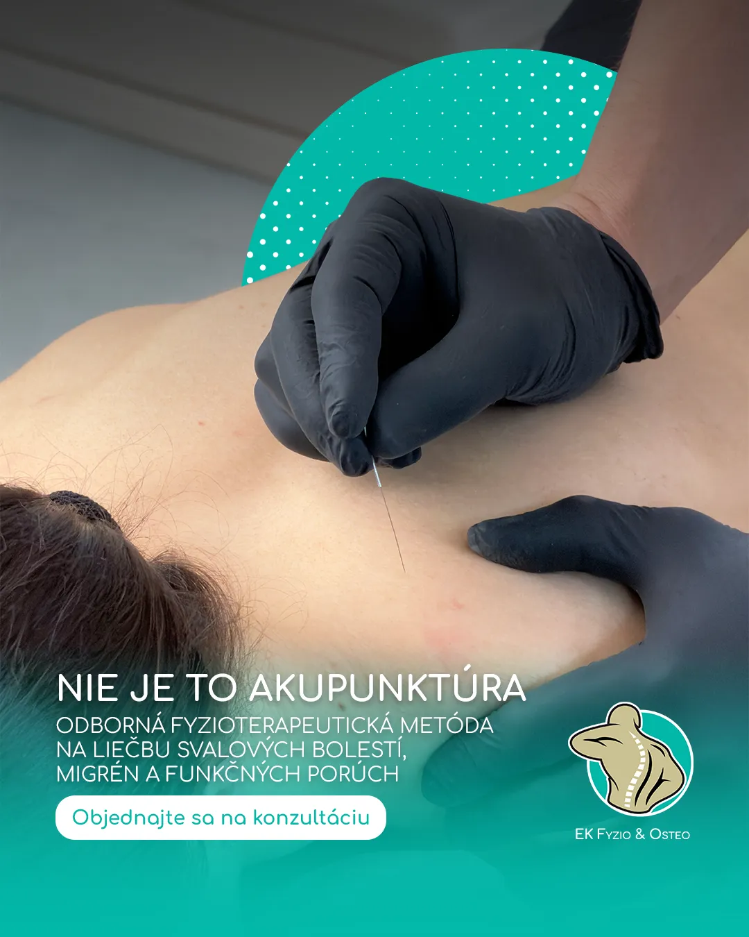 Grafika EK Fyzio & Osteo: nie je to akupunktúra